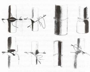 Histoire-de-la-Chirurgie-Vasculaire-Figure5_large.jpg